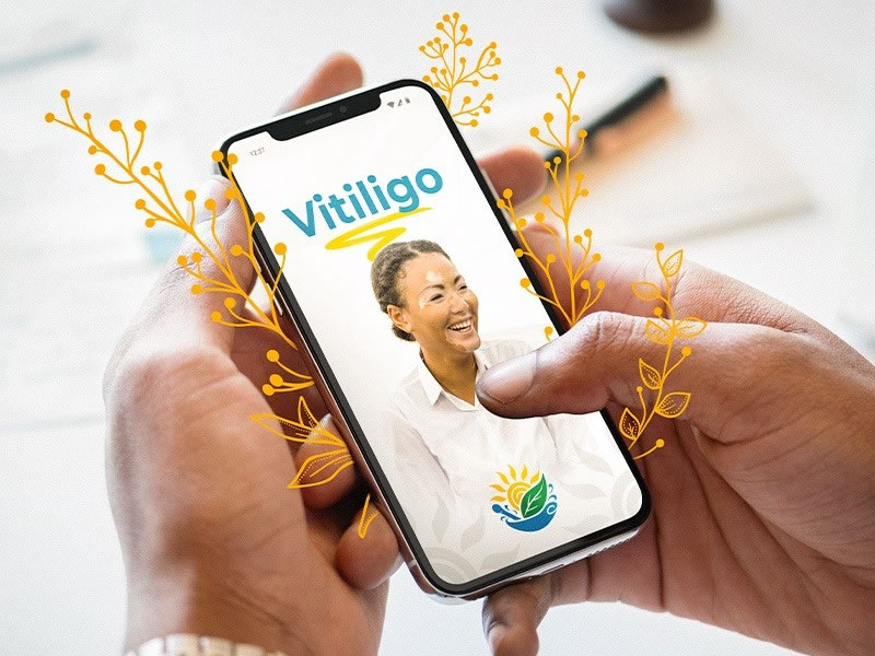 Vitiligo: vamos aprender sobre essa condição?